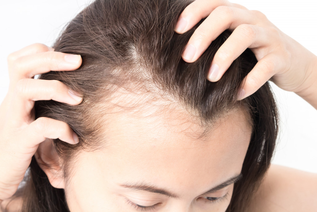 person with hair loss